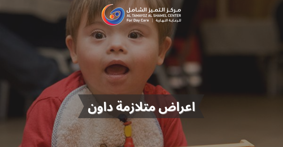 اعراض متلازمة داون